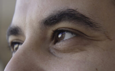 How Much Does LASIK Eye Surgery Cost?